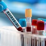 hematologia-1-925x305